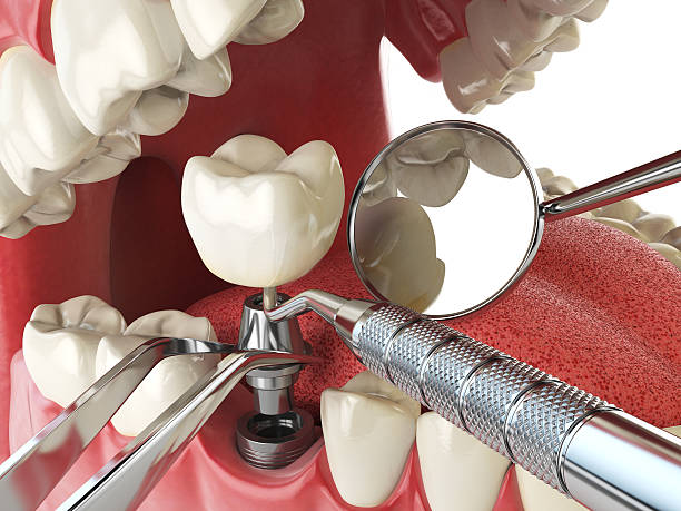 Best Broken Tooth Emergency  in San Clemente, CA